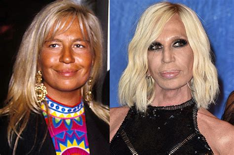 Donatella Versace, la verità sulle operazioni di chirurgia estetica .